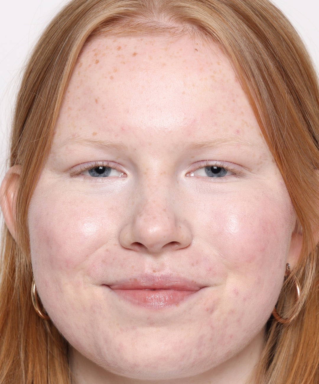 Concealer